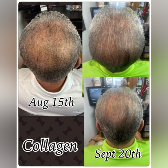 Collagen - Picture 2 of 3